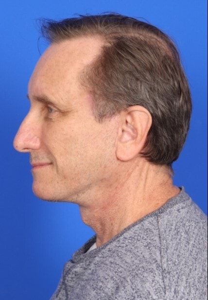 after image