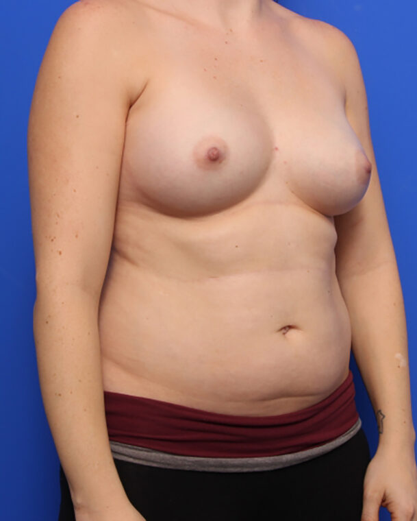 bna image