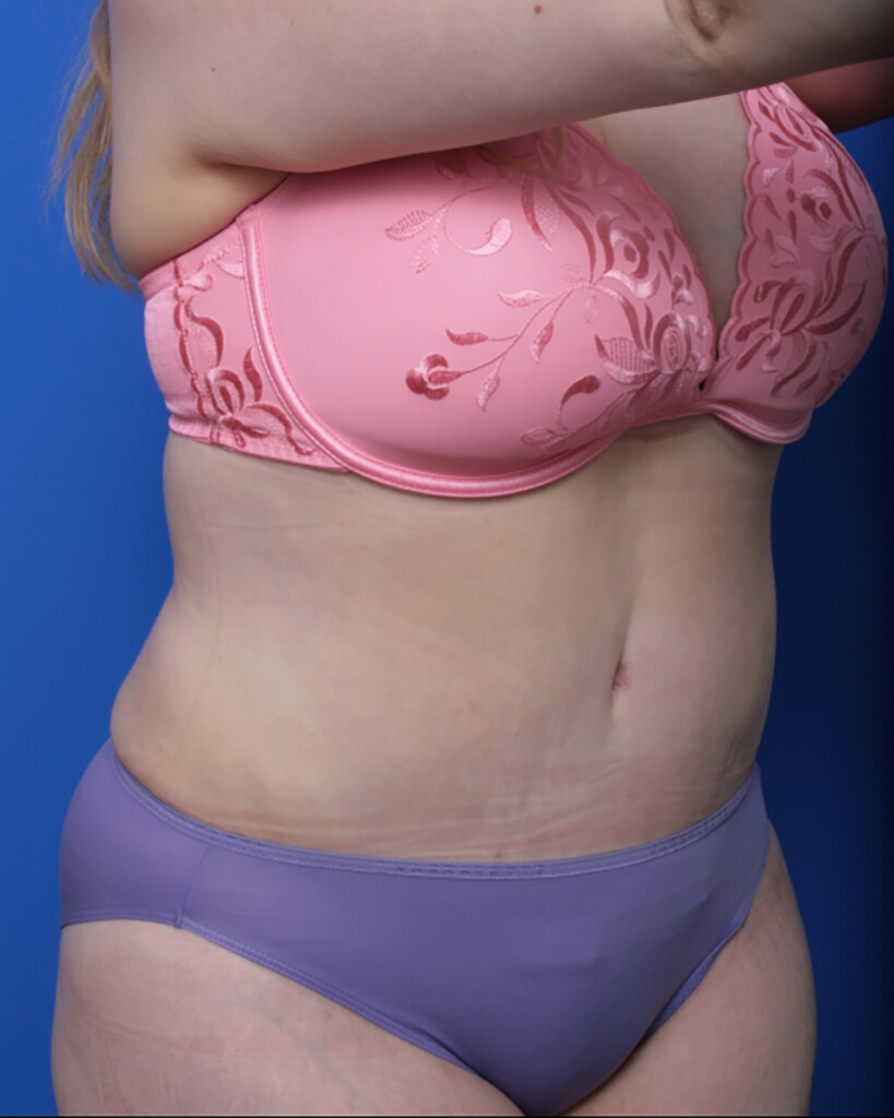 bna image