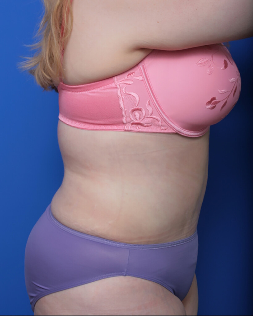 bna image