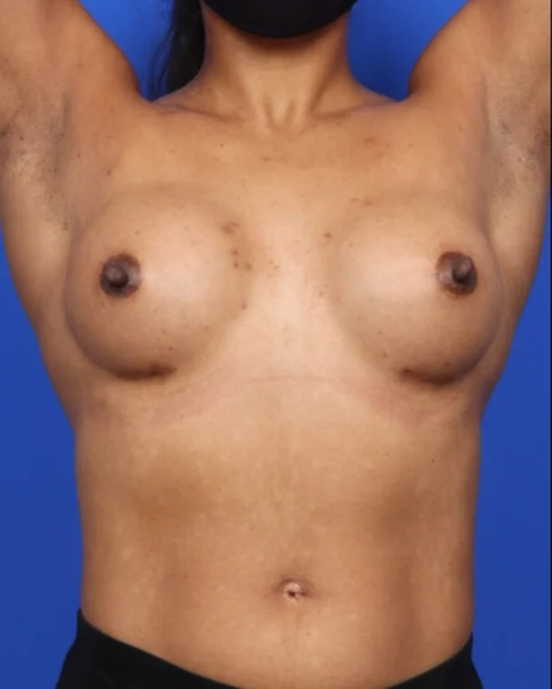 after image