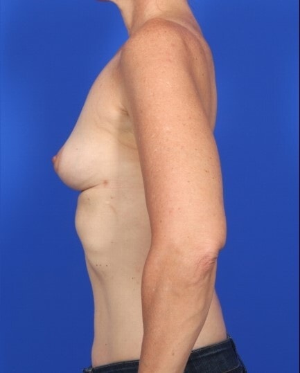 after image