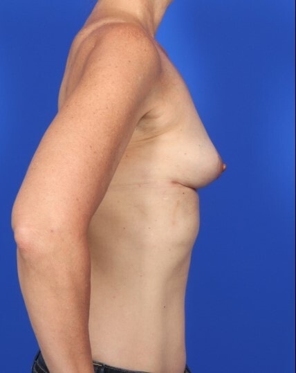 after image