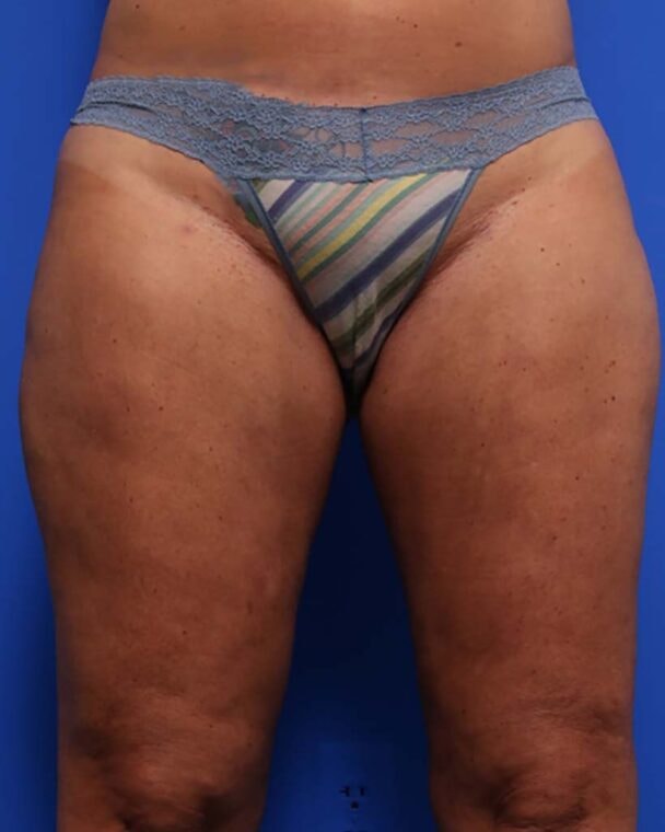 after image