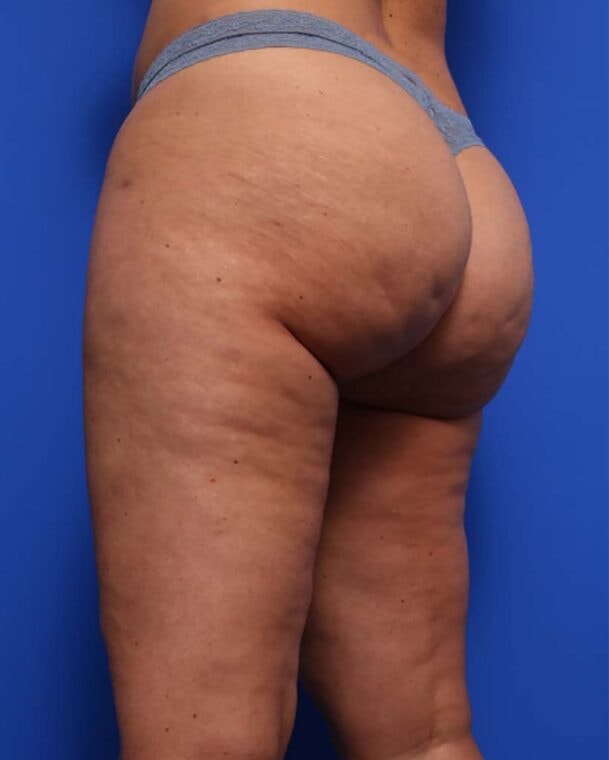 after image