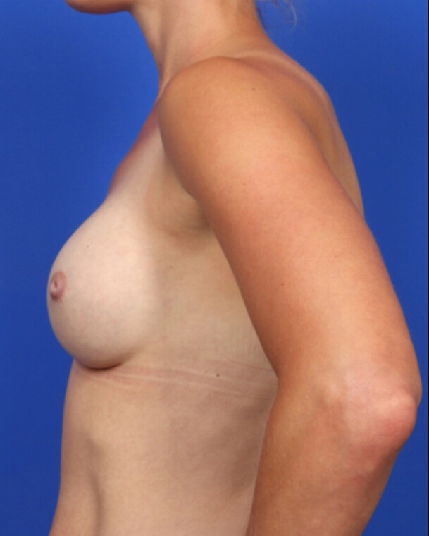 after image