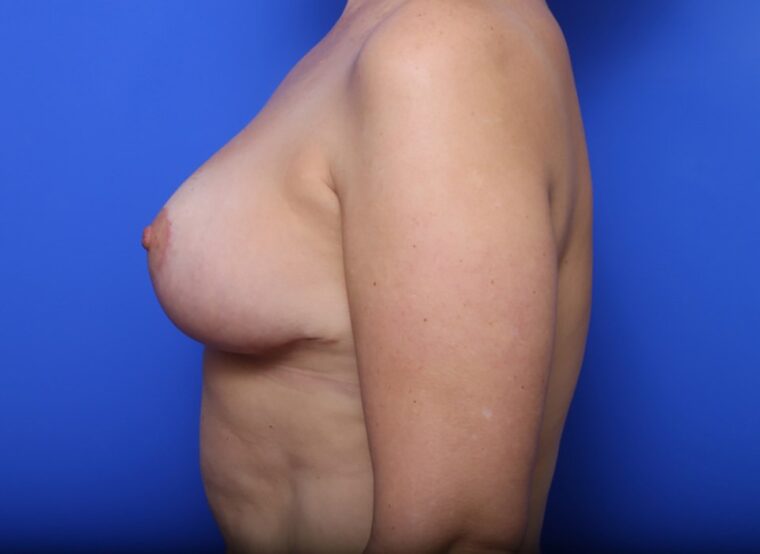 after image