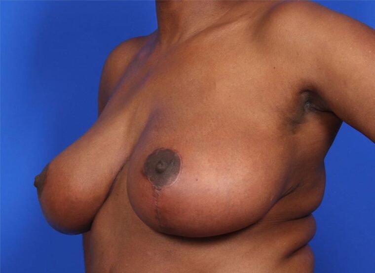 after image