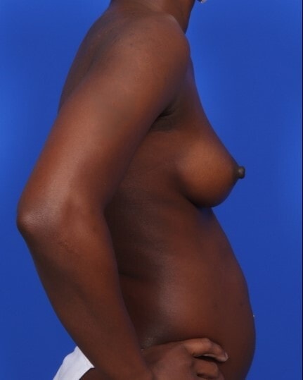 after image