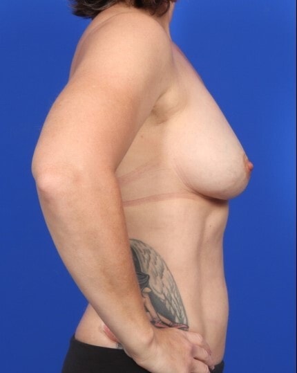 after image