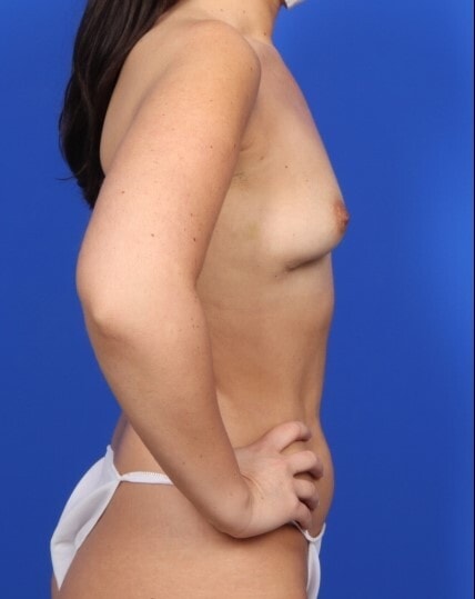 after image