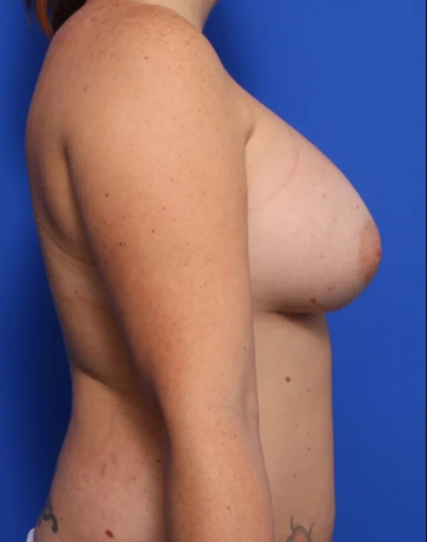 after image