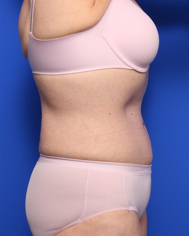 after image