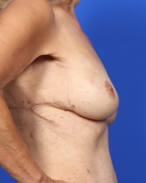 after image