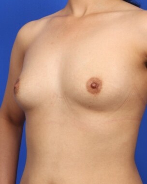 Case # 34 before photo