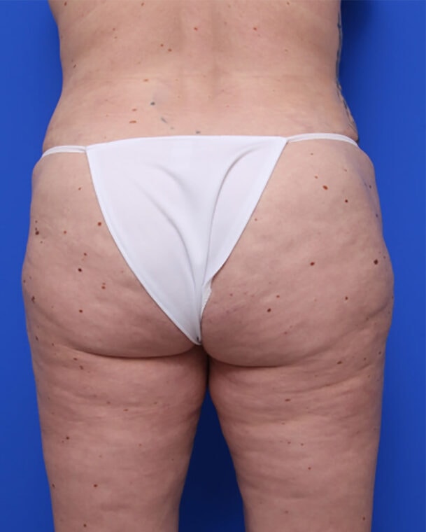 after image