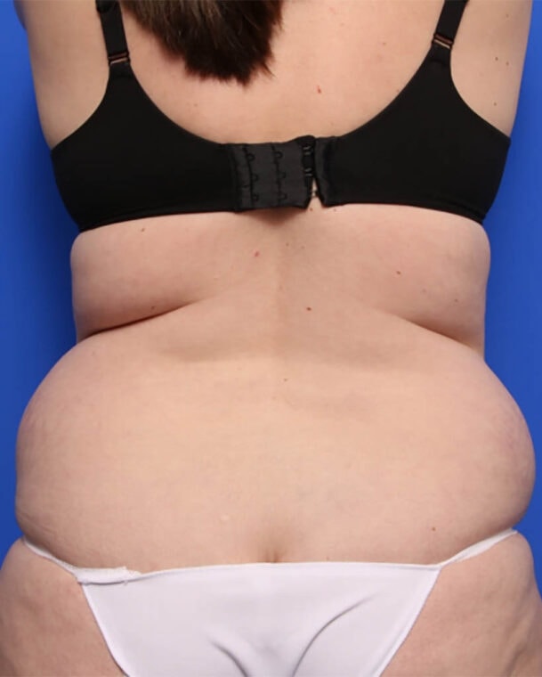 before image