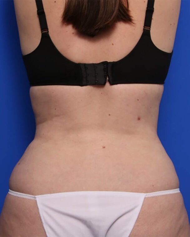 after image