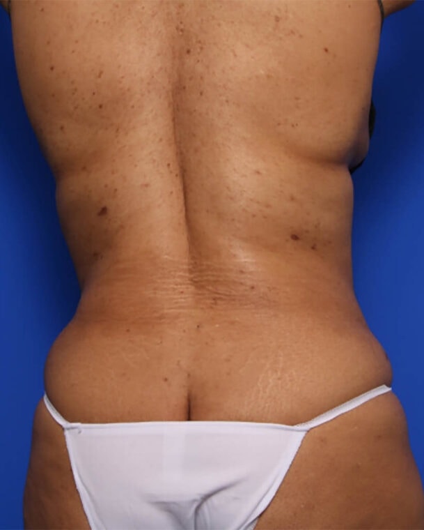 after image