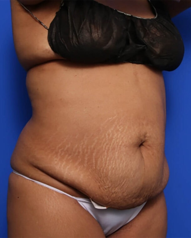 before image