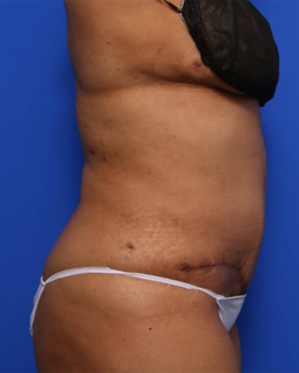 after image