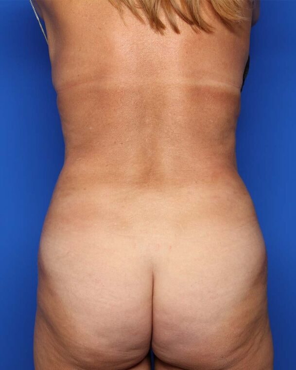 after image