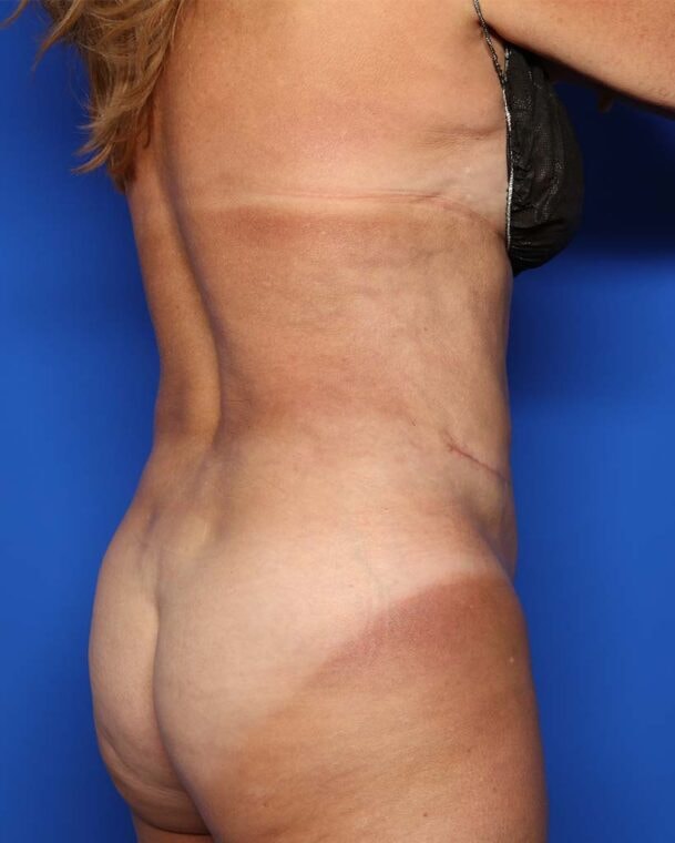 after image