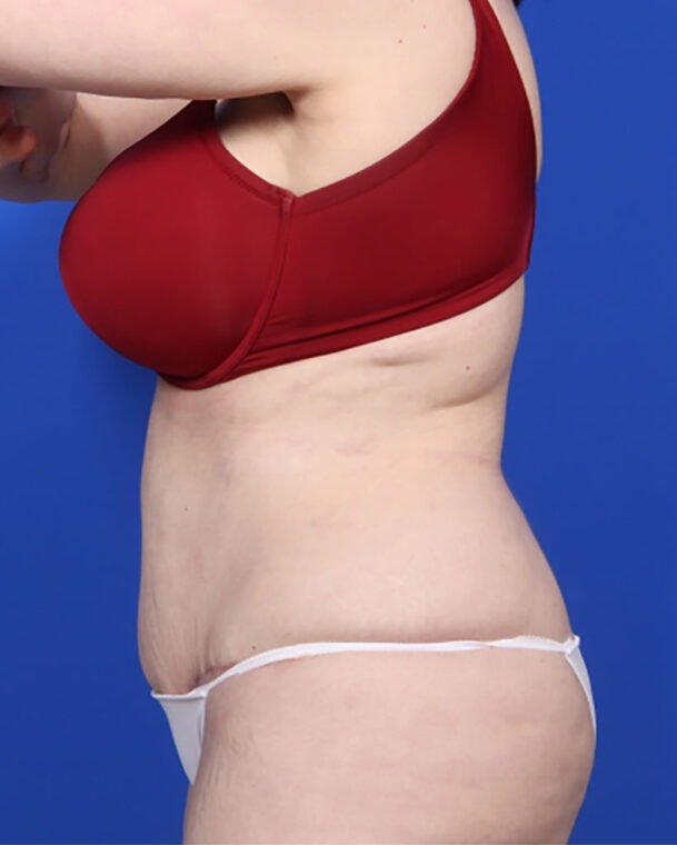 after image