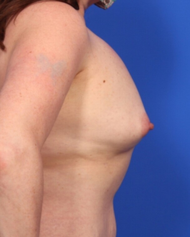 after image