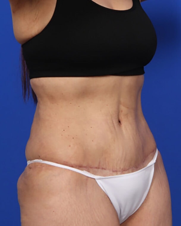 after image