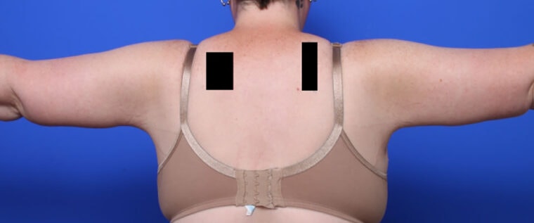 after image