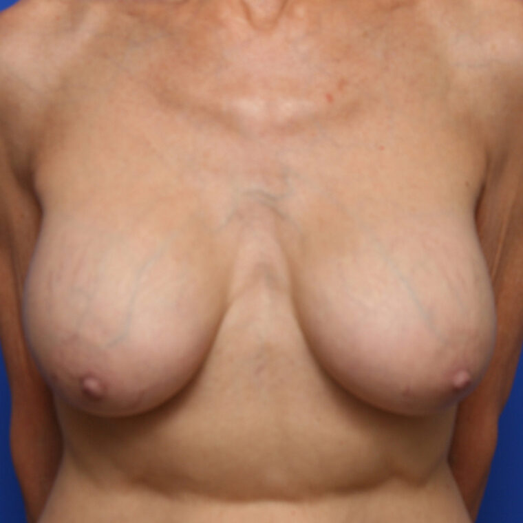 after image