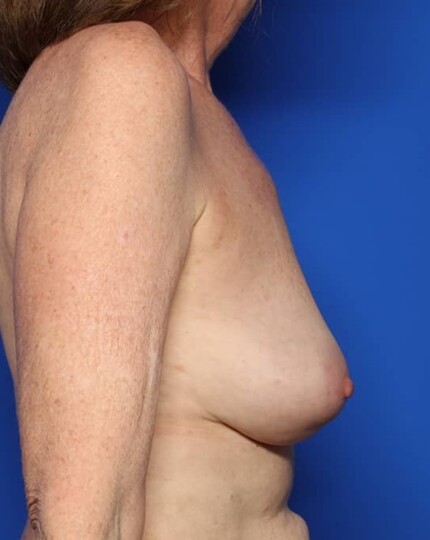 after image