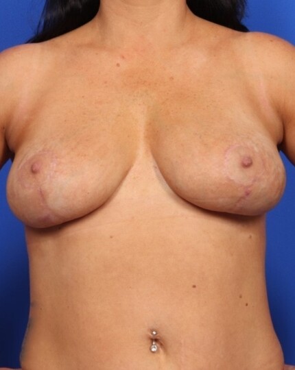 after image