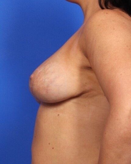 after image