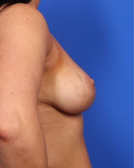 after image