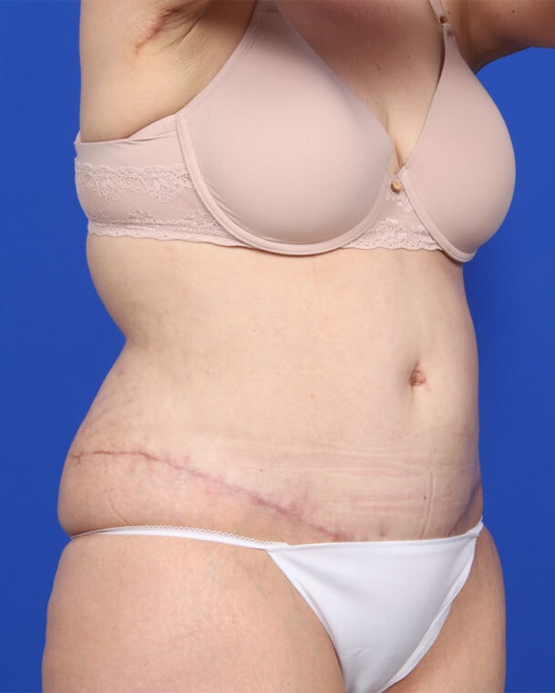 after image