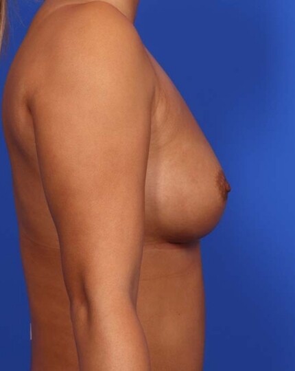after image