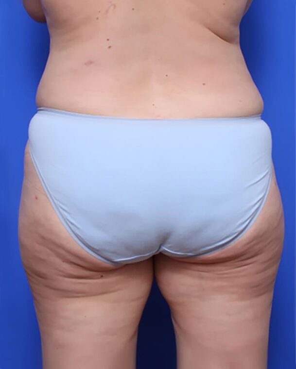 after image