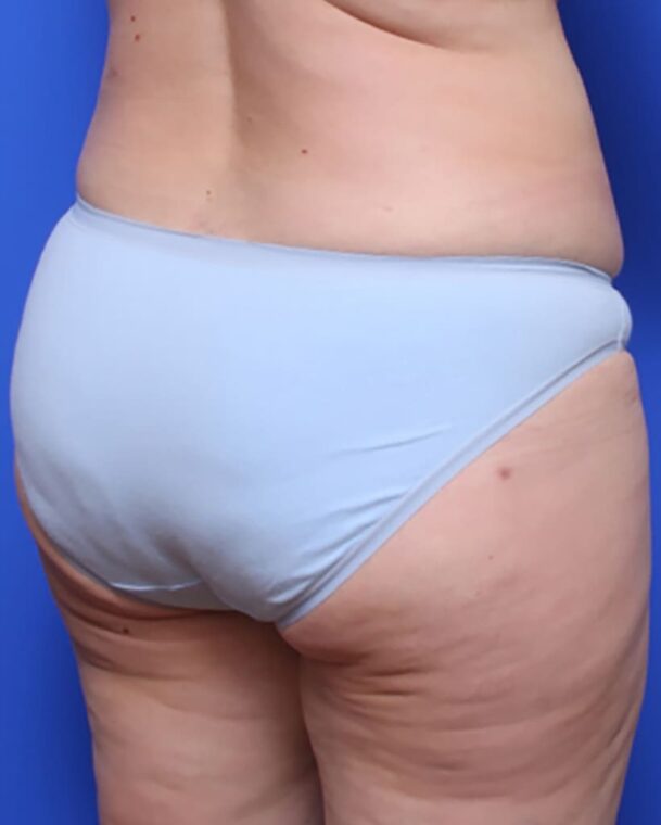 after image